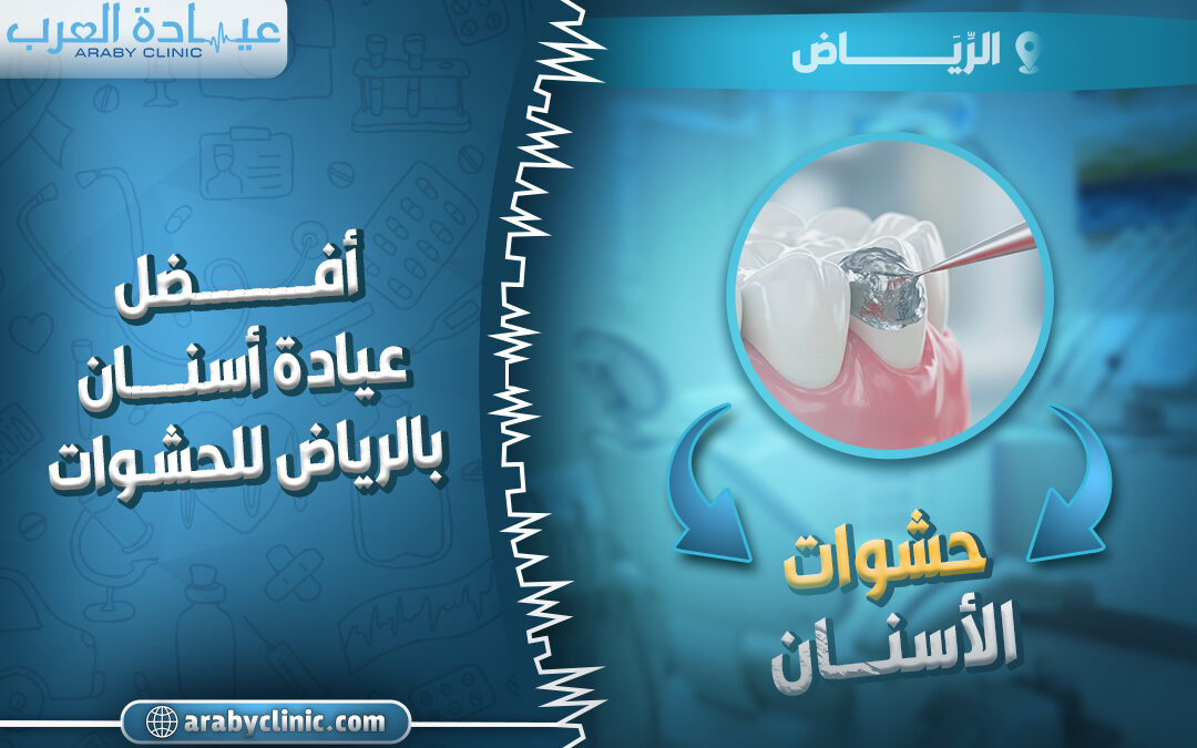 احجز في افضل عيادة اسنان بالرياض للحشوات