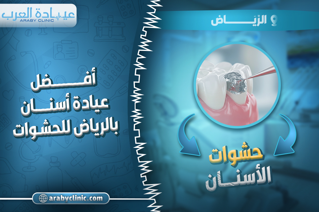 افضل عيادة اسنان بالرياض للحشوات